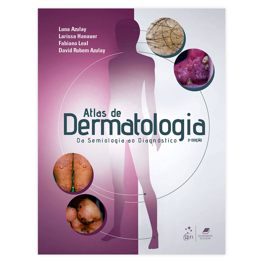 Livro - Atlas de Dermatologia - Da Semiologia ao Diagnóstico 3ª Edição