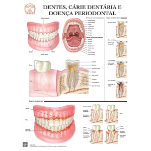 Pôster Dentes, Cárie Dentária e Doença Periodontal