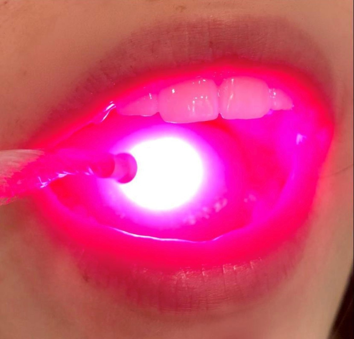 Imersão: Laser em Odontologia  - PUC Minas