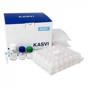 Kit de Extração de DNA, Mini Spin Vírus DNA/RNA, 250 Extrações, K9-1250 - Kasvi